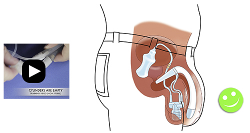 Inflatable Penile Implant ZSI 475 6