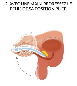 zsi 100 ftm fonctionnement