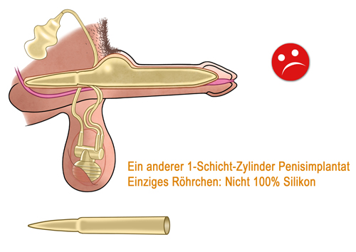 Hydraulische Penisprothese ZSI 475 2