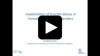 Penile Implant following Phalloplasty